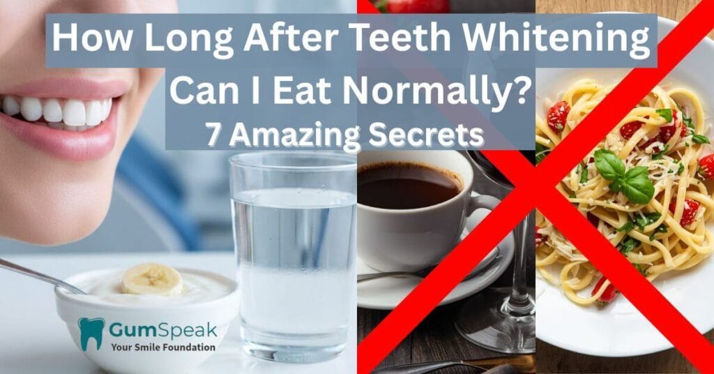 How long after teeth whitening can I eat normally guide