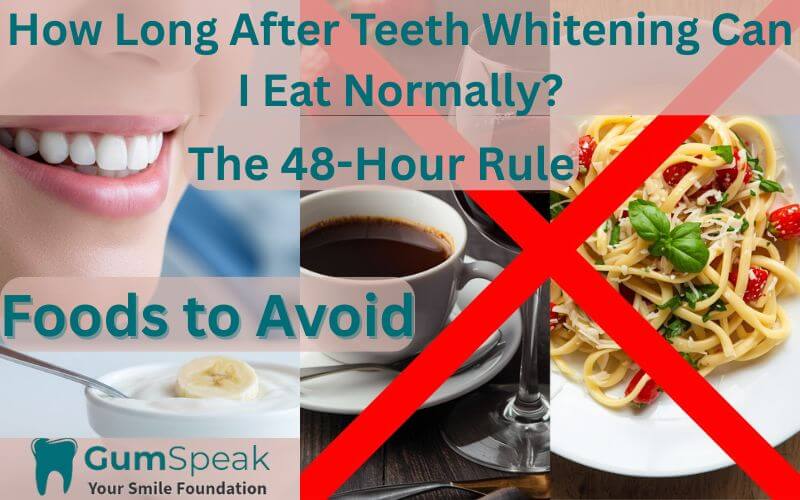 How long after teeth whitening can I eat normally guide