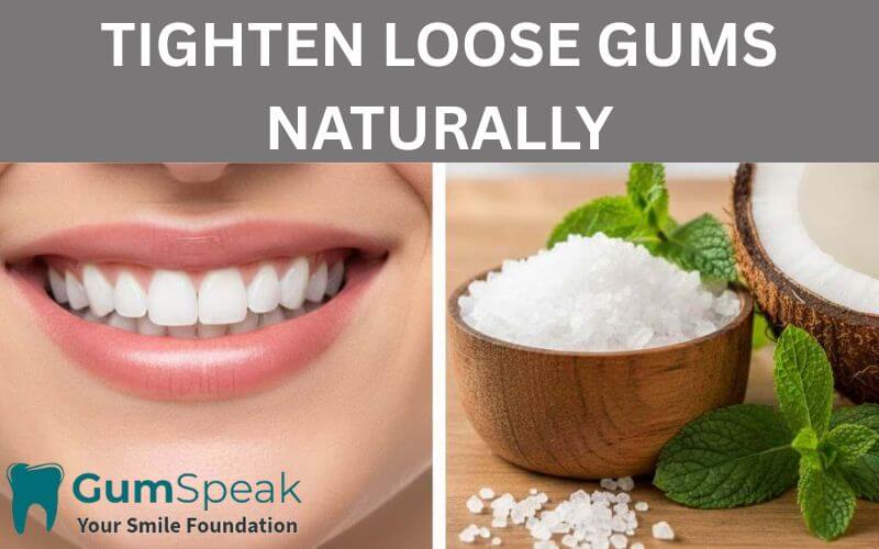 How to tighten loose gums naturally with home remedies