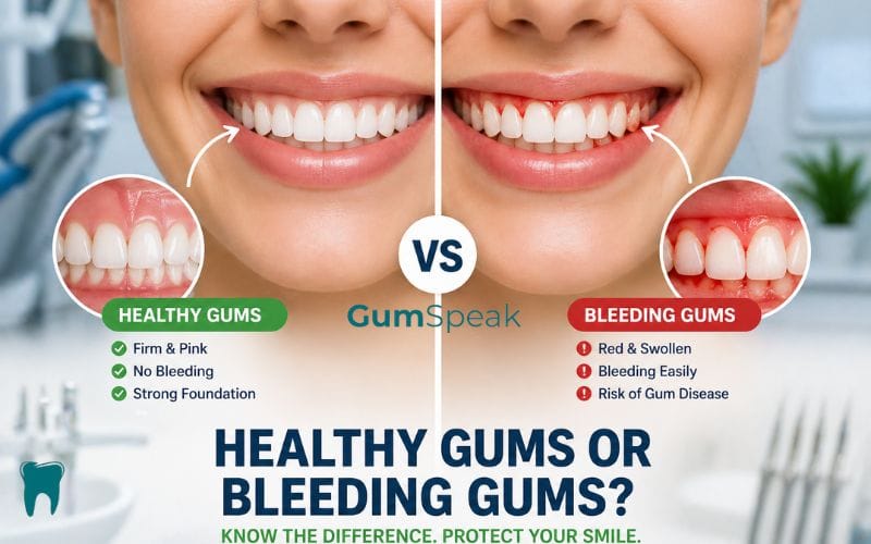 healthy gums vs bleeding gums symptoms comparison